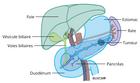 Tumeur pancréatique dans le segment de la queue